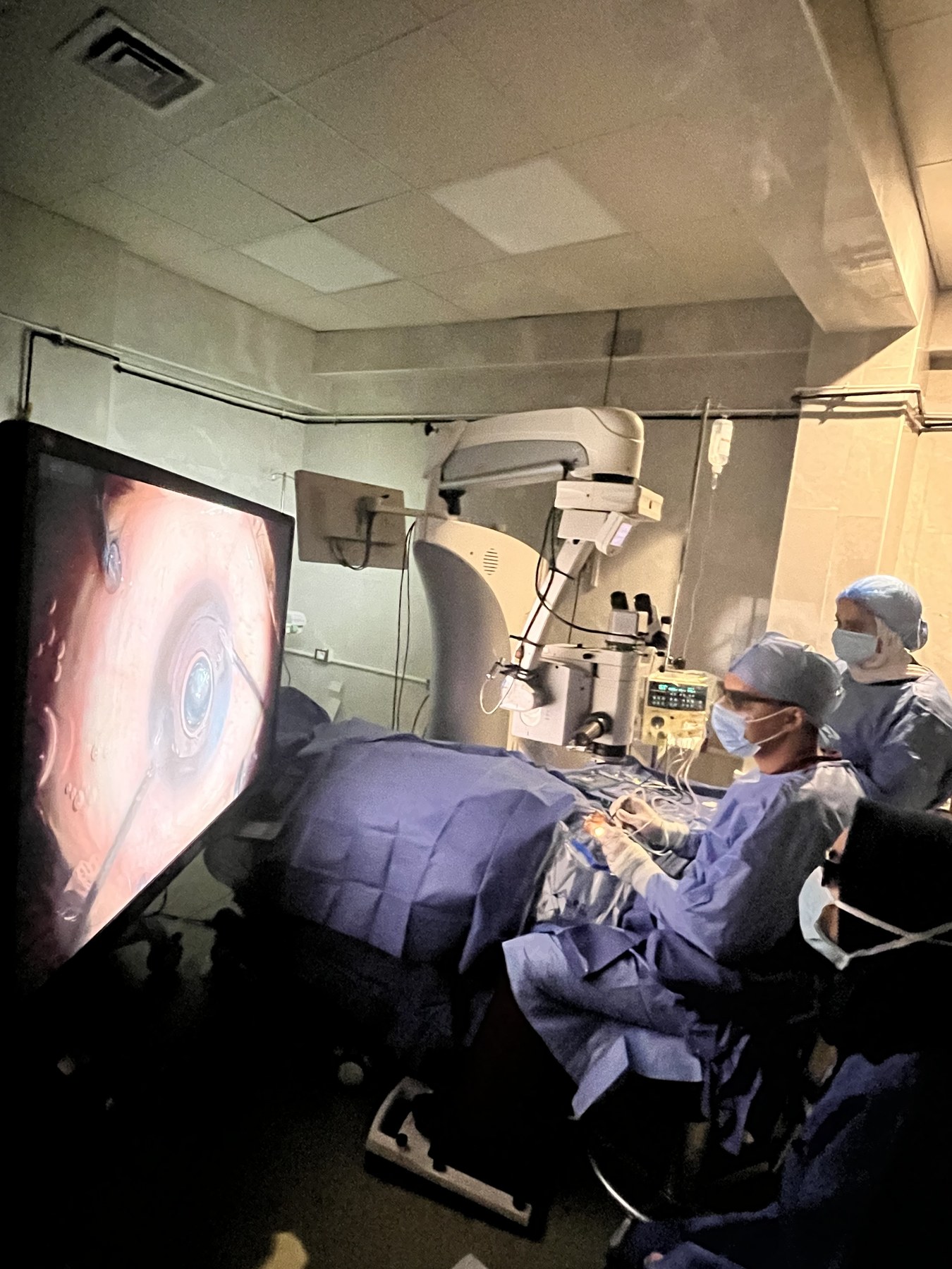 جراحة شبكية باستخدام الميكروسكوب وعرض قاع العين